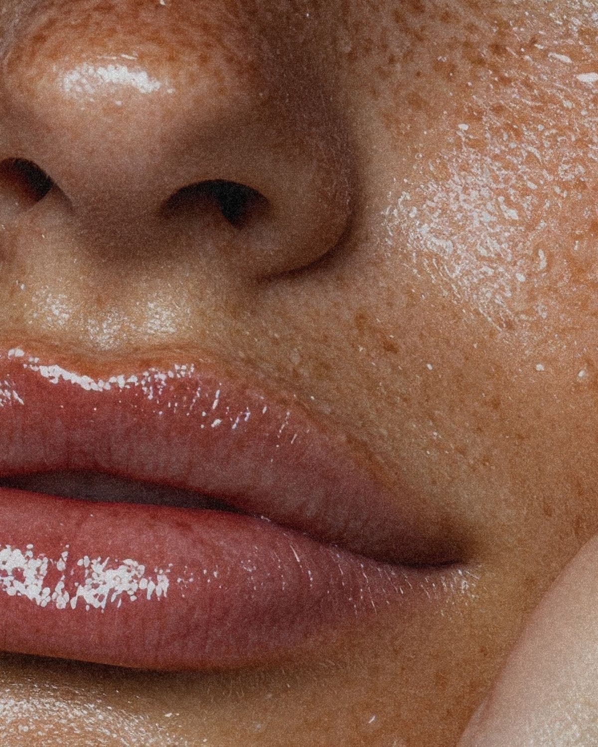 Lip Filler Cost in Austin: What 0.2ml, 0.5ml and 1ml Actually Get You